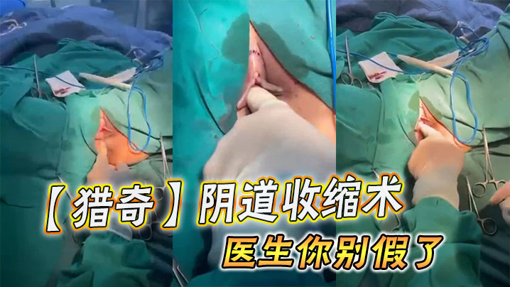 【猎奇】阴道收缩术，医生你别假了}